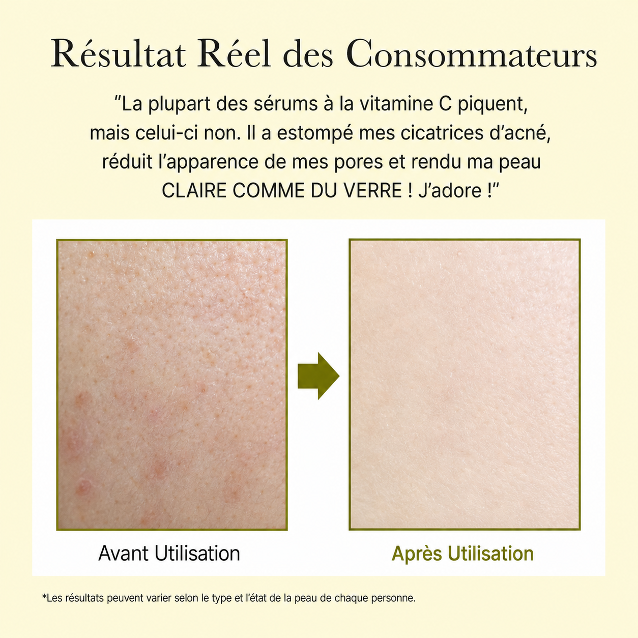 Sérum Anti-Âge Meyora  Vitamine C & Éclat 30 ml